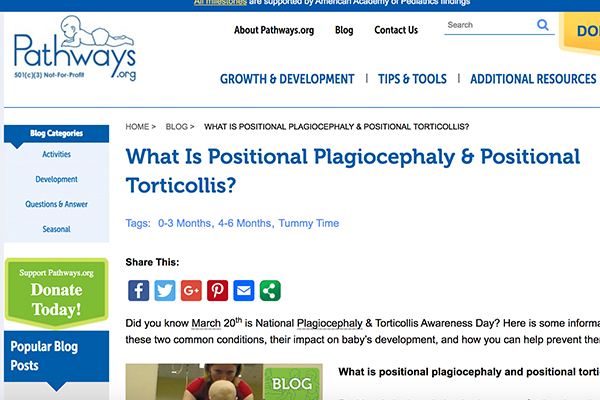 Plagiocephaly resource